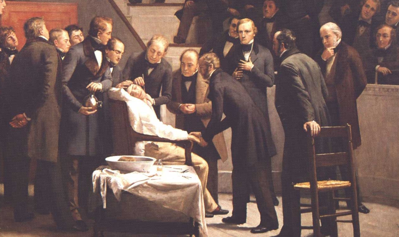 Tranh minh họa ca phẫu thuật gây mê toàn thân đầu tiên trên thế giới của William Morton. Ảnh: History.