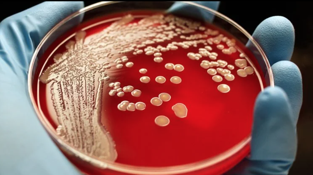 Các loài vi sinh vật có thể nuôi cấy trong đĩa petri chỉ là một phần nhỏ của vi khuẩn