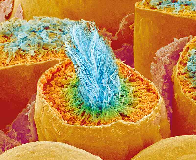 Hình ảnh hiển vi điện tử quét quá trình sản xuất tinh trùng. Trong hình: Đầu tinh trùng (xanh lá cây) và đuôi (xanh lam). Ảnh: Susumu Nishinaga / SPL