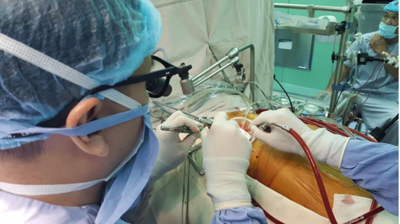 Phẫu thuật tim ít xâm lấn ở Bệnh viện Đại học y dược TPHCM