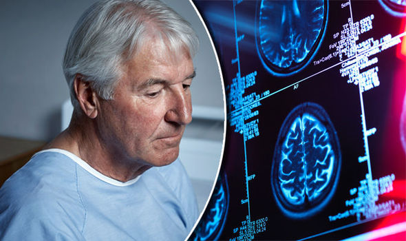 Việc sử dụng vi khuẩn đường ruột có thể làm giảm quá trình suy giảm trí nhớ của người cao tuổi. Nguồn: Daily Express