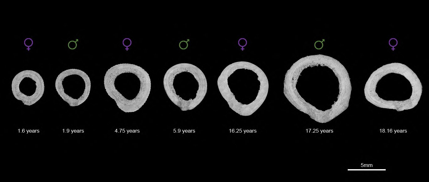 Hình ảnh hiển vi mặt cắt ngang của bảy xương đùi trong nghiên cứu, được phân loại theo độ tuổi và giới tính. Nguồn: phys.org