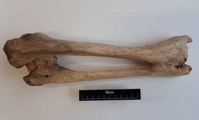 Xương chày và xương mác của một người đàn ông 1.000 tuổi có khối u xương được tìm thấy trong một nghĩa địa cổ ở Co Donegal.