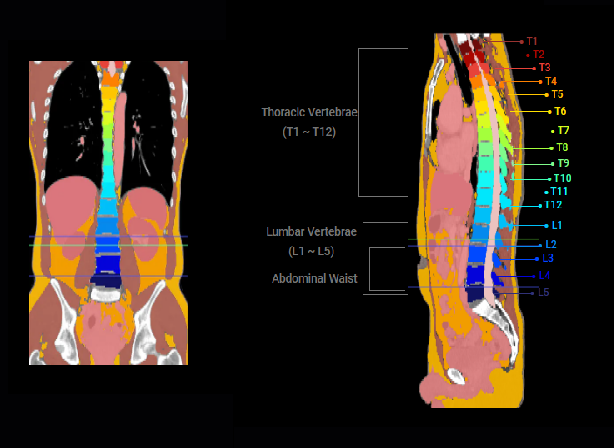  theo dõi và định lượng dữ liệu giải phẫu thông qua bản song sinh kỹ thuật số tạo ra từ ảnh chụp CT. Ảnh: Medical IP