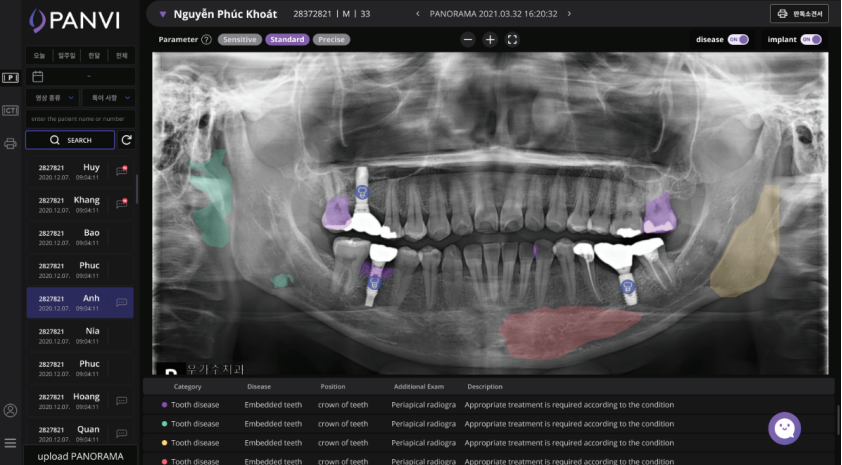 Công nghệ AI giúp phát hiện các oại bệnh răng miệng và implant từ ảnh chụp X-Quang. Ảnh: Invisible Lab