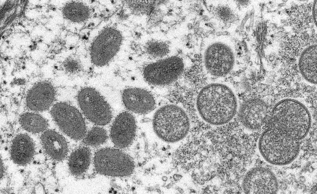 Hình ảnh hiển vi điện tử của virus đậu mùa khỉ trong đợt bùng phát vào năm 2003. (Ảnh: Reuters)