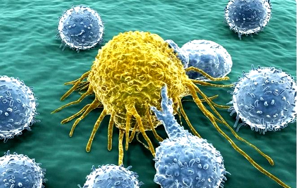 Tế bào ung thư (màu vàng). Ảnh: Juan Gaertner.