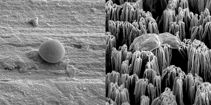 Một tế bào Candida còn nguyên vẹn trên bề mặt titan được đánh bóng (trái) và một tế bào Candida bị vỡ trên bề mặt titan có gai vi mô (phải). Ảnh: RMIT