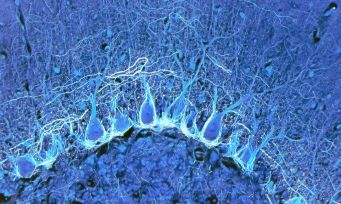 Tế bào Purkinje, những tế bào thần kinh lớn trong tiểu não, nằm ở phía sau và phía dưới của não. Ảnh: Steve Gschmeissner/Science Photo Library