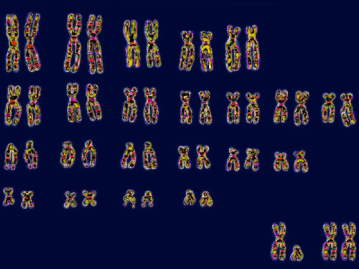 23 cặp nhiễm sắc thể ở người. Những người có hai nhiễm sắc thể X dài (hình góc dưới bên phải) dễ mắc bệnh tự miễn hơn nhiều so với những người có 1 nhiễm sắc thể X và 1 nhiễm sắc thể Y ngắn. Ảnh: BSIP 