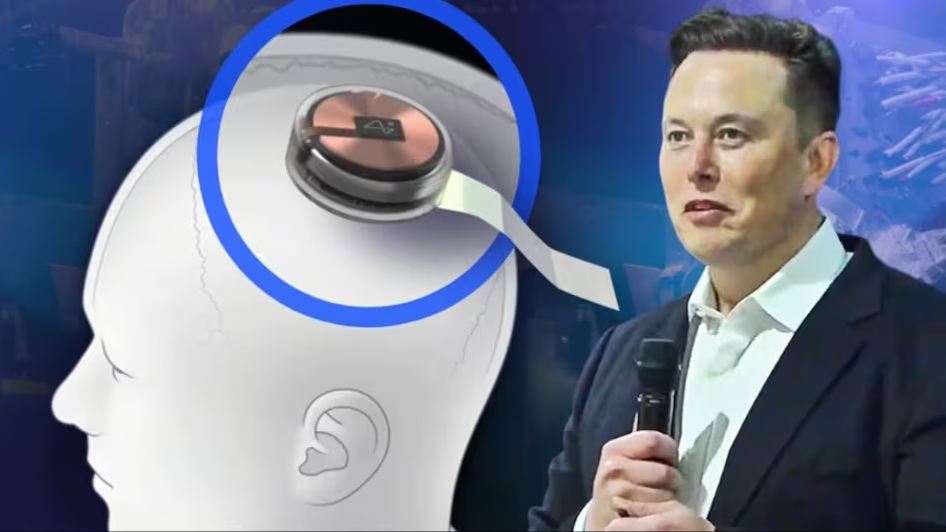 Elon Musk thành lập Neuralink để phát triển giao diện não – máy tính. Ảnh: Neuralink