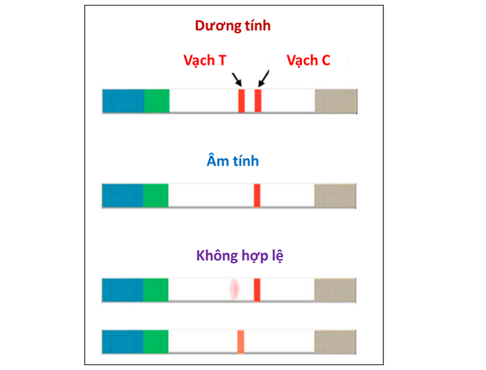 Hình 2: Hình ảnh kết quả xét nghiệm thông qua sự hiện diện màu sắc trên vạch thử nghiệm và vạch đối chứng của que thử LFIA cấu trúc “sandwich”.