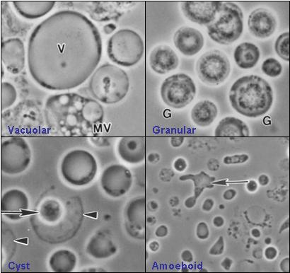 Vi khuẩn Blastocystis. Ảnh: Valentia Lim Zhining (2006)