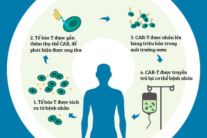 Minh họa liệu pháp tế bào CAR-T. Minh họa liệu pháp tế bào CAR-T.