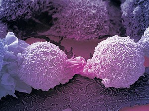 Biến đổi thành công tế bào ung thư thành tế bào thường