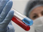 Phát hiện “siêu kháng thể” tiêu diệt virus HIV