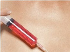 Sơ cứu khi vô tình bị đâm kim tiêm nghi dính máu HIV