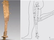 Phát hiện chân giả 2.200 năm tuổi trong mộ cổ ở Trung Quốc