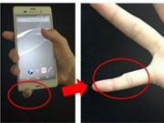 Sự thật việc dùng smartphone gây biến dạng ngón út