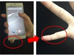 Sự thật việc dùng smartphone gây biến dạng ngón út