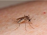 Cách phân biệt dấu hiệu bệnh do virus Zika và do sốt xuất huyết