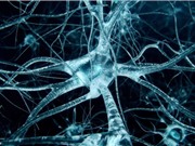 Mỹ: "Thay não" để điều trị các bệnh về thần kinh