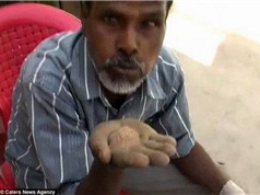 Ấn Độ: Khó tin với người đàn ông ăn cát thay cơm suốt 25 năm