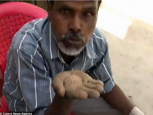 Ấn Độ: Khó tin với người đàn ông ăn cát thay cơm suốt 25 năm