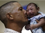 Quy trình xét nghiệm virus Zika tại Việt Nam