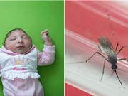 Brazil công bố bằng chứng Zika lây truyền qua muỗi Aedes aegypti