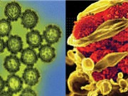 Virus khác vi khuẩn chỗ nào?