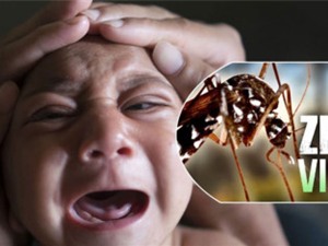 Em bé Việt Nam đầu tiên nghi mắc chứng đầu nhỏ do virus Zika