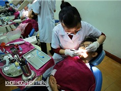 Tế bào gốc răng sữa chữa được bệnh gì?