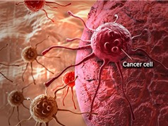 Phát hiện phương pháp "vô hiệu hóa" sự lan rộng tế bào ung thư