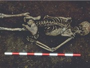 Bộ xương người đàn ông bị mất lưỡi hơn nghìn tuổi ở Anh