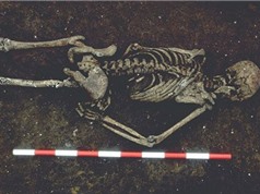 Bộ xương người đàn ông bị mất lưỡi hơn nghìn tuổi ở Anh