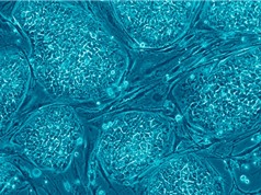 Phát hiện mới: Tìm ra cách sửa tế bào già thành tế bào trẻ