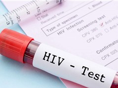 Tìm ra phương pháp xét nghiệm HIV mới cho kết quả nhanh nhất