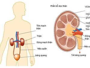 Dấu hiệu của viêm cầu thận