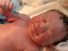 Em bé chào đời tay cầm vòng tránh thai của mẹ