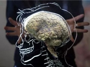Nhà khoa học tuyên bố giúp người chết não sống lại