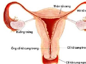 "Thủ phạm" gây ung thư cổ tử cung nhiều bạn tình nên cảnh giác