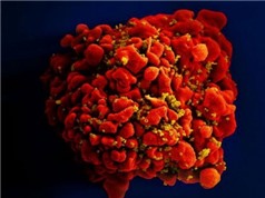 Ca nhiễm virus HIV được chữa khỏi thứ 3 trên thế giới