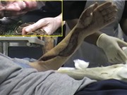 Suýt mất cánh tay vì "nghịch ngu" với rắn độc