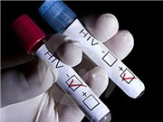 Số người Hà Nội, TP HCM nhiễm HIV tăng đột biến