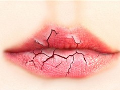 Clip: Bí quyết chăm sóc đôi môi nứt nẻ hiệu quả tại nhà