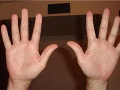 Tại sao con người có 10 ngón tay?