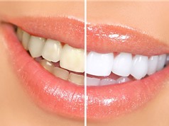 Clip: 10 mẹo hay làm trắng răng bằng nguyên liệu có sẵn trong bếp