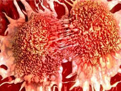 Tế bào biến thành ung thư chỉ qua một bước đột biến đơn giản