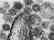 Mỹ bỏ lệnh cấm gây quỹ cho nghiên cứu các loại virus “chết người”